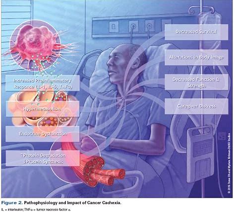 MdFacep's tweet photo. End this #cancers silent Killer with #Amniostem, the universal Stem Cell Donor Cells from $CELZ. A revolutionary treatment option for those afflicted by cancer and cachexia. Creative Medical Technology Holdings Aims to Treat Cancer Associated Wasting (Cachexia) Using AmnioStem!!. https://t.co/xzmMAANGNE
