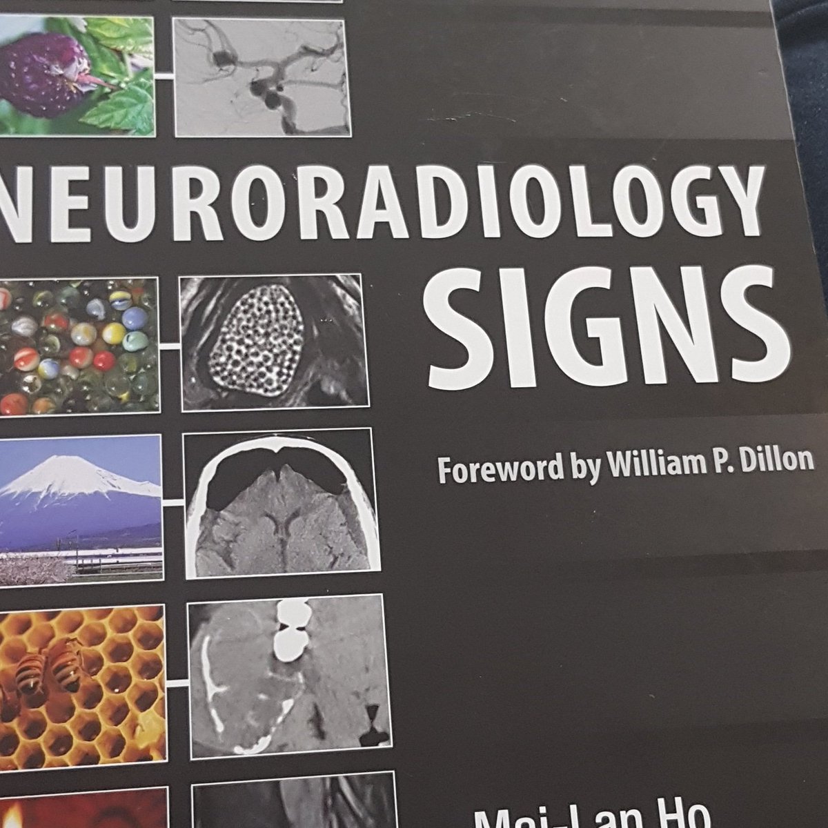 SignsRadiology's tweet photo. Every day we'll post a radiological sign and explain about it. This is the first book that we're going to scrutinize! Have fun!! https://t.co/M6uuIAhOFY