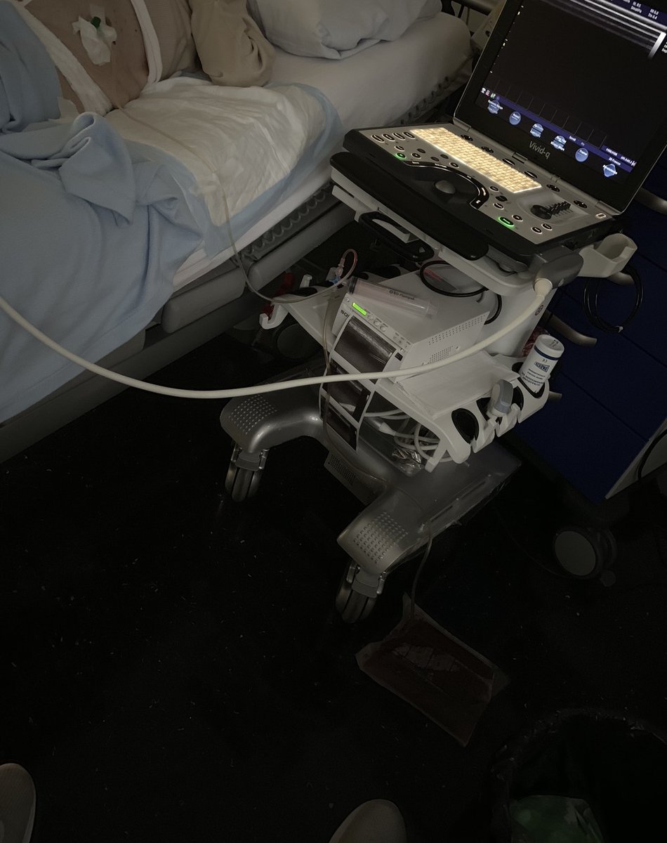 SportklinikBern's tweet photo. Today emergency room service for x-mas with ultrasound guided Aszites puncture (5.7l)... no muscle injury today...🧐 I ❤️ ultrasound- even the vivid-q...😉 #ultrasoundguidedpuncture #aszites #pocus #ershift #emergencyroom #xmas https://t.co/OGNW0xK0TM
