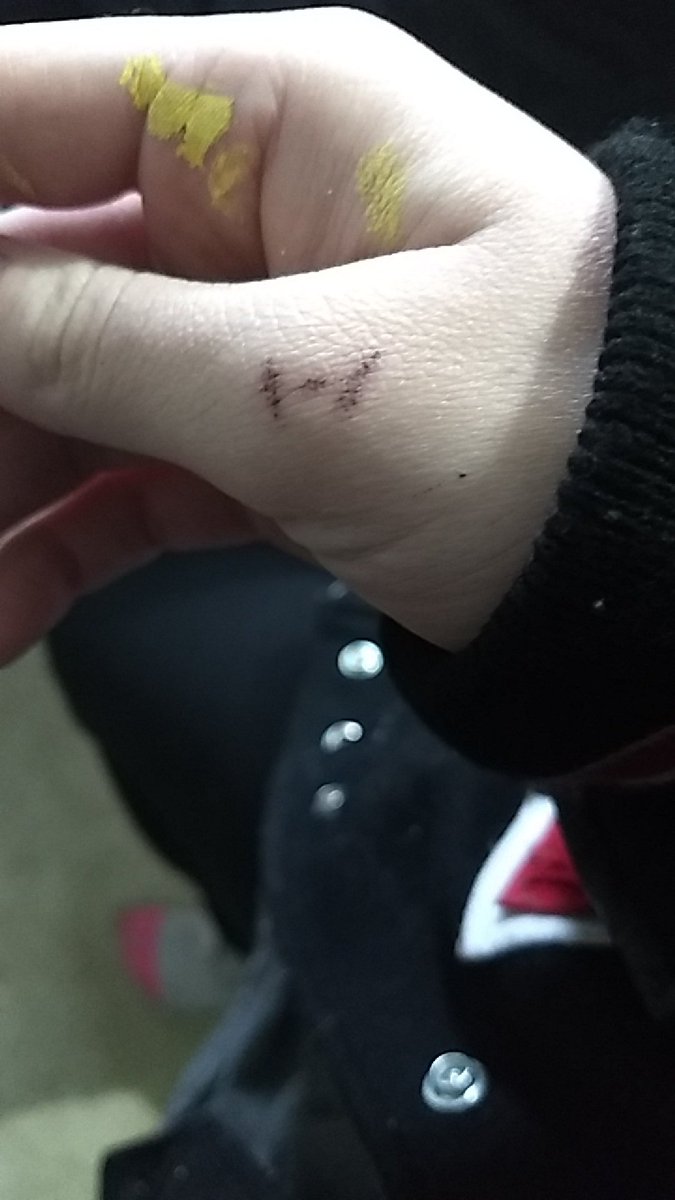 HaileyMassey5's tweet photo. Hi. I gave myself 2 tattoos last night. I'm stupid. :)
|-/
t's uncrossed and i's undotted
ones on my hand and the others on my ankle.
@twentyonepilots @tylerrjoseph @joshuadun #CliqueArt #cliquemas #TwentyOnePilots #holdingontoyou #imakebaddecisions https://t.co/TXqUfE3TZ3