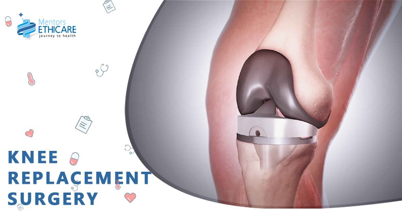 MEthicare's tweet photo. #Knee Replacement surgery
Variable reasons contribute to Joint pain and stiffness. The answer lies in the comprehension of the possible causes and treatment options...
https://t.co/P97zaS72GO
#Kneereplacement #kneesurgery #Unilateralkneesurgery #surgery #health #medicaltravel https://t.co/gXGvRM01Cb