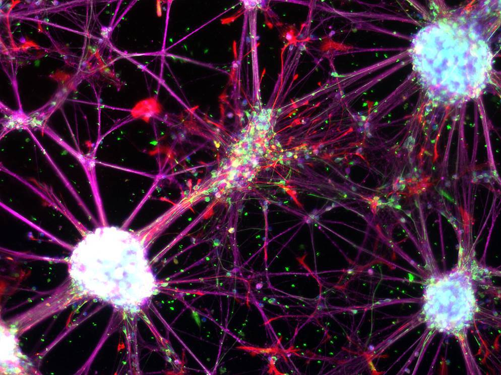 1 стволовые клетки. Стволовые клетки. Нейроны. Стволовая клетка. Нервные стволовые клетки.