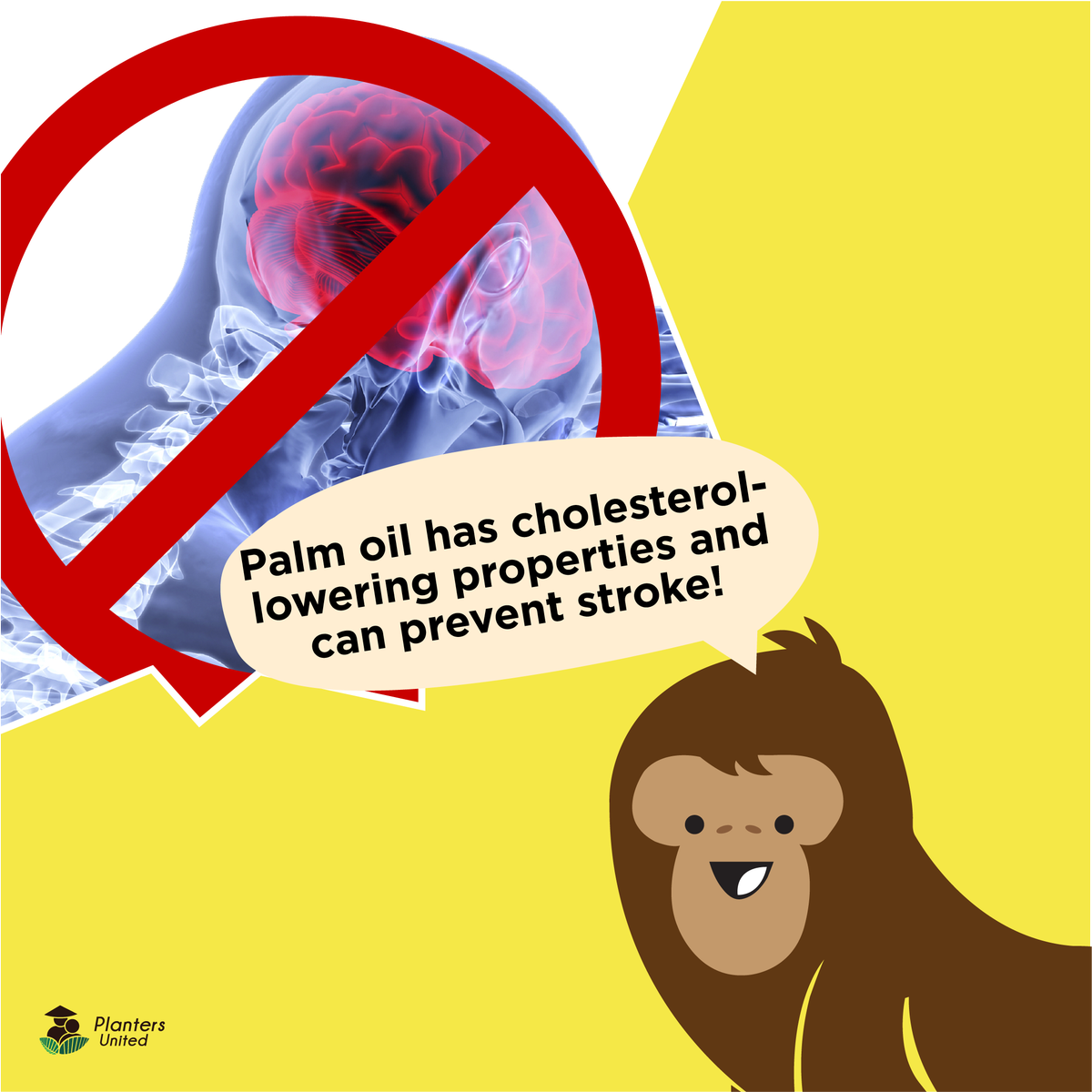 plantersunited's tweet photo. Palm oil contains vitamin E tocotrienols and pro-Vitamin A carotenoids. Torotrienols has cholesterol-lowering properties and helps prevent the onset of certain strokes in human. #PalmOilForHealth, #CheaperNotInferior https://t.co/ccLfNLwelG
