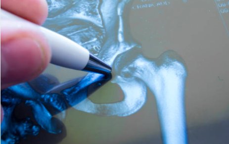 arthronix's tweet photo. Educate yourself on joint replacement and learn how it has the potential to reduce pain and improve your life: https://t.co/DkRg5CzcIy. #jointreplacement #kneereplacement #hipreplacement #health #innovation https://t.co/w5hidkkXrT