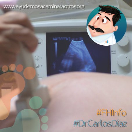 FHayudaacamina's tweet photo. #FHInfo El diagnóstico es radiológico y puede realizarse en forma prenatal por ultrasonografía y en forma posnatal por radiografías #DrCarlosDíaz https://t.co/0AY0nwrCD6