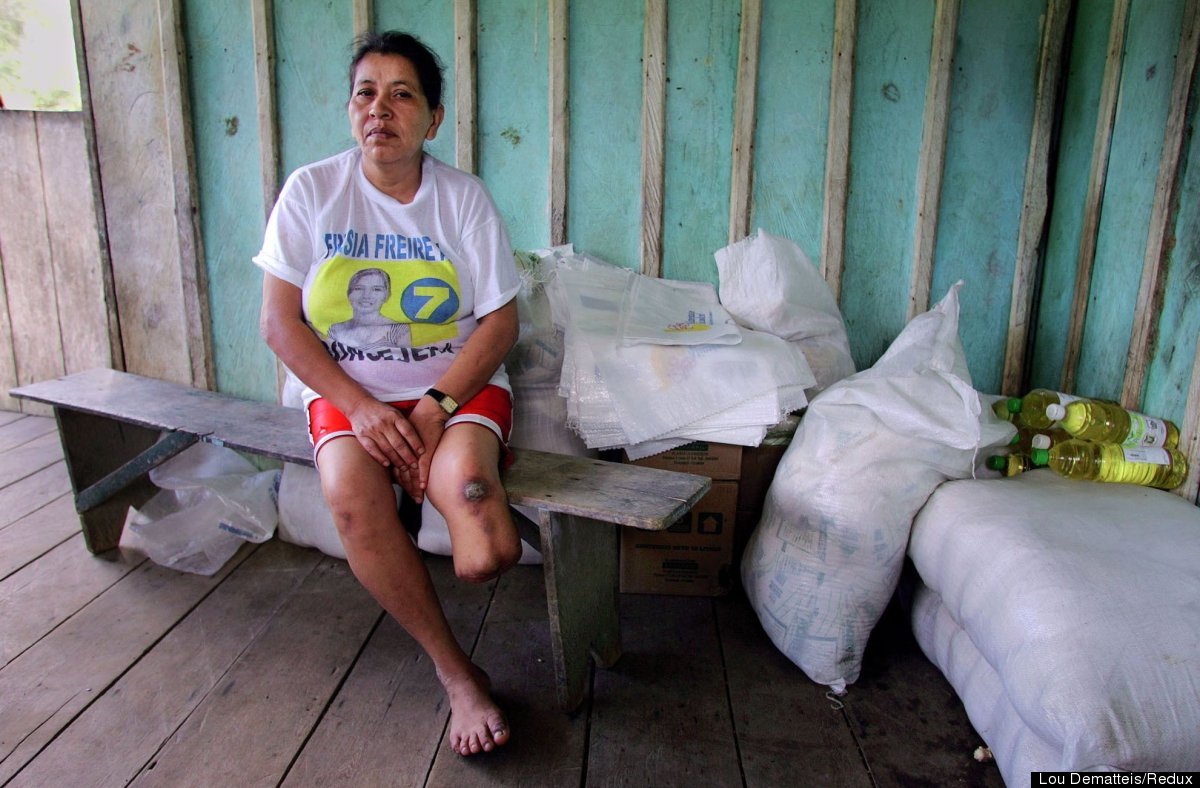 SDonziger's tweet photo. AT CHRISTMAS, REMEMBER CHEVRON'S VICTIMS: In Ecuador's Amazon, doctors amputated the leg of Modesto Briones after she was exposed to life-threatening oil waste at @Chevron's Parahuaco oil well #2. @Lenin @juanseroldan @rogerwaters @ABFalecbaldwin @KarenHinton @AmazonWatch https://t.co/YT4Ex3el78