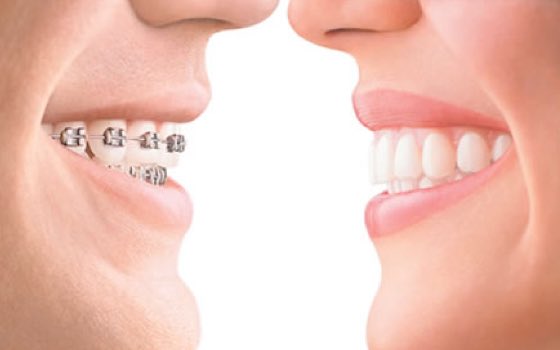 ¿Quieres lucir sonrisa? En Dental Galbis te ayudamos a cumplir tus propósitos.
👉Somos expertos en #Ortodoncia e #Implantología
 
> Primera visita gratuita
> Diagnóstico y presupuesto sin compromiso
> Financiación hasta 36 meses sin intereses
> Máxima calidad