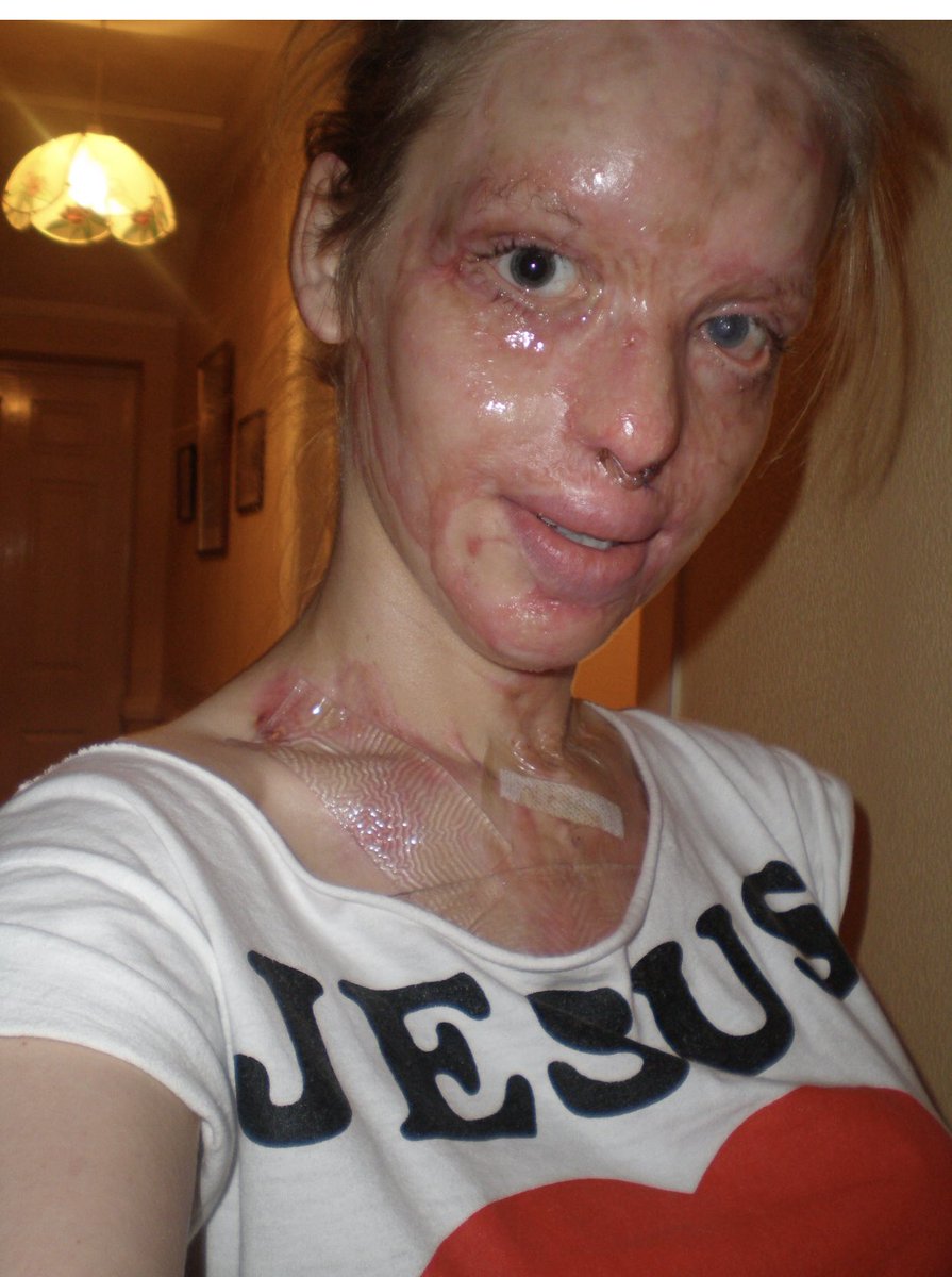 KatiePiper_'s tweet image. 1st pic Christmas tonight!
2nd pic Christmas Last year
3rd pic Christmas 7 years ago
4th pic Christmas 9 years ago
Time flys, mindset changes, new challenges arise but always grateful for life