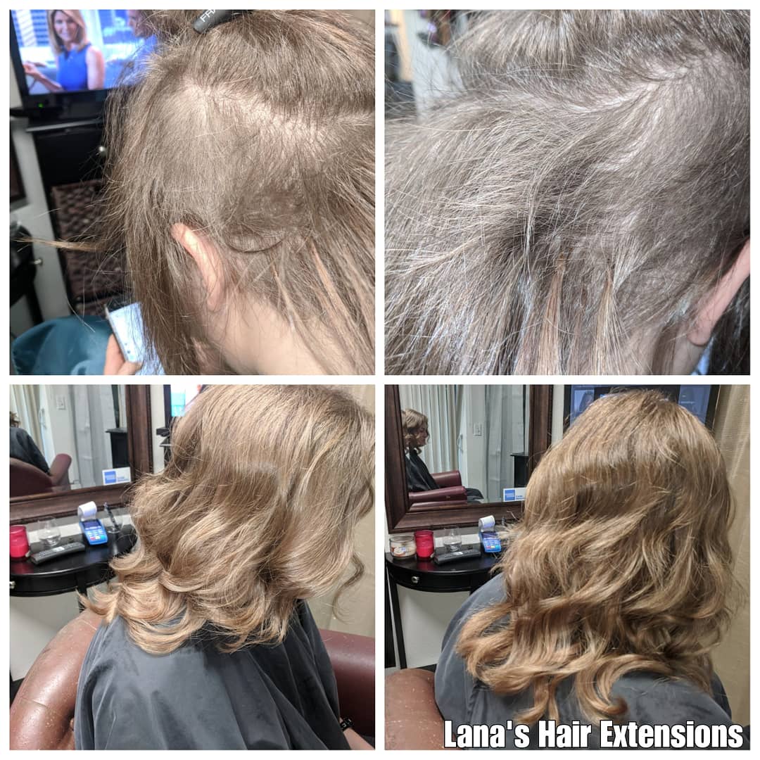 Lanabeautyshop's tweet image. #Trichotillomania. #FusionHairExtensions #keratinhairextensions
#Lanashairextensions