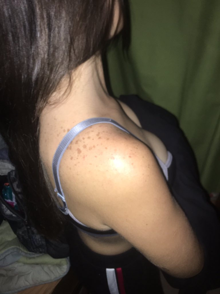 GoddessVeronicx's tweet photo. Wish someone would worship these fleckles. #ass #fleckles #paypig #findom #sugardaddy #fetish #cashslave #tributes #pay #pervert https://t.co/tUkY5hhZsR
