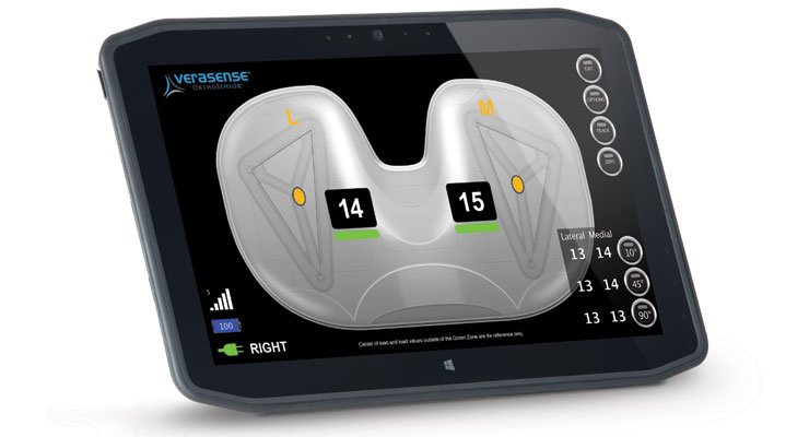 ODT #ReadersChoice top 10 for 2018: #7—Bright horizons: Highlighting 6 #orthopedic technology companies to watch! <a href="/BionessLiveOn/">Bioness Medical, Inc.</a> <a href="/wishbonemedical/">WishBone Medical</a> @orthosensor <a href="/Gramercy_Ortho/">Gramercy Ortho</a> --> ow.ly/iotB30n379t