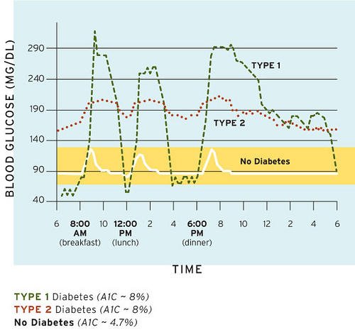 425_ad's tweet photo. Blood Glucose readings may vary considerably, the target A1C is most likely lower. A person without diabetes stays within a narrow band, ranging from about 70 to 130 mg/dl. The person with type 1 diabetes,oscillates widely between low and high depending on insulin/food intake. https://t.co/IHlSoOVJgP