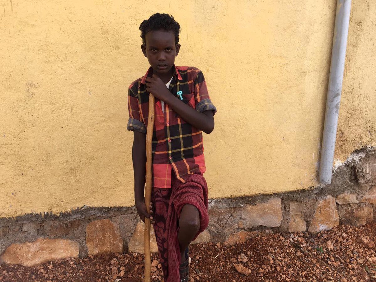 OfficialOYSU's tweet photo. A few wks ago we shared with you the story of 13yr old Idris from Qubi. Thanks to the support offered by youth from around the world, we were able to bring Idris from Qubbi to Jigjiga to receive medical attention. https://t.co/2J5DaXvfL9
