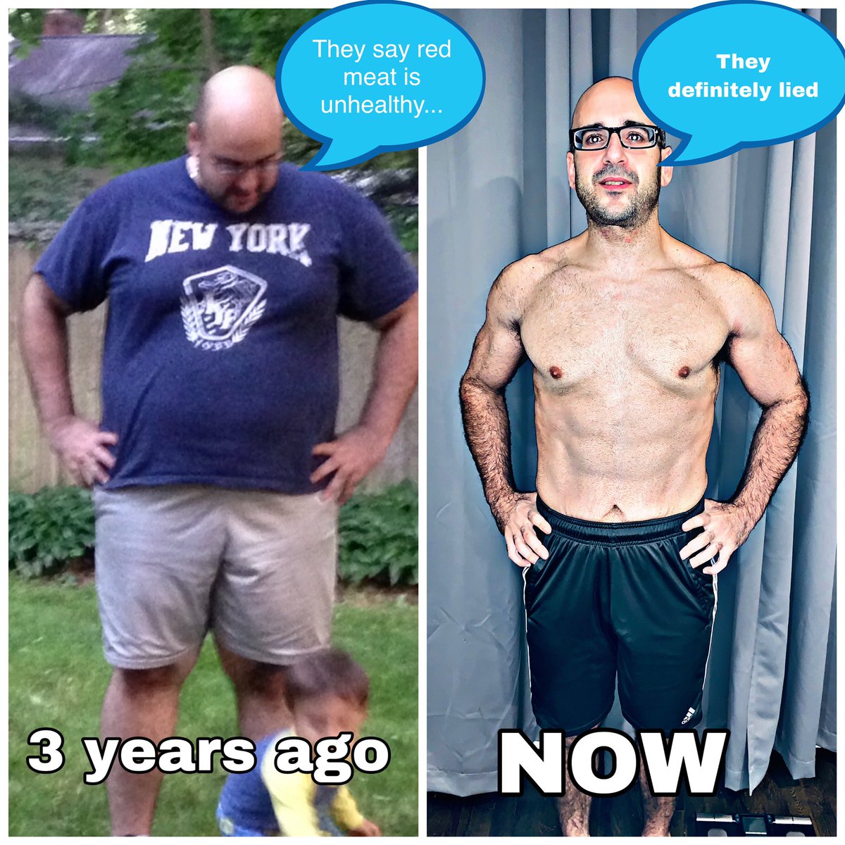 DoctorTro's tweet photo. I lost 150lbs in 3 years by ignoring conventional medicine

❌never counted calories
❌didnt eat multiple small meals
❌never portion controlled
❌almost no carbs
✅eggs🍳
✅red meat🥩
✅dairy🥛
✅fasted 16-22 hours/day🕣
EVERY marker of health is improved

“They definitely lied” https://t.co/oo6Hgrsbjl