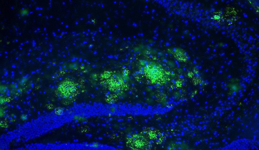 ajitjohnson_n's tweet photo. Researchers have identified a drinkable cocktail of designer molecules that interferes with a crucial first step of Alzheimer’s, &amp; even restores memories in mice. The next step is to verify the compounds aren’t toxic for clinical trials on humans. https://t.co/tKk25pVQtQ https://t.co/qAqoAkrmfX