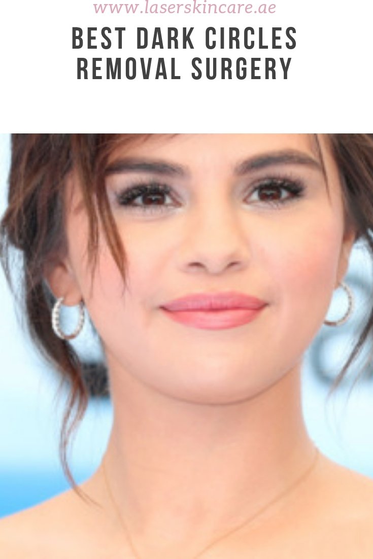 Dark circles that are caused by hyper-pigmentation are hereditary and can't be treated aside from with surgeries. Dark Circles Removal in Dubai is best place to get rid of dark circles under eye. bit.ly/2GD6Nya