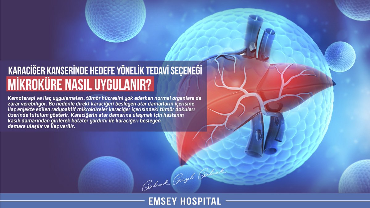 Karaciğer kanserinde hedefe yönelik tedavi seçeneği Mikroküre nasıl uygulanır?
🔹
#emseyhospital #sağlık #karaciğerkanseri #mikroküre #tedavi #kansertedavisi #kansersizyaşam #sağlık #sağlıklıyaşam #kurtköy #istanbul #gelecekgüzelgelecek