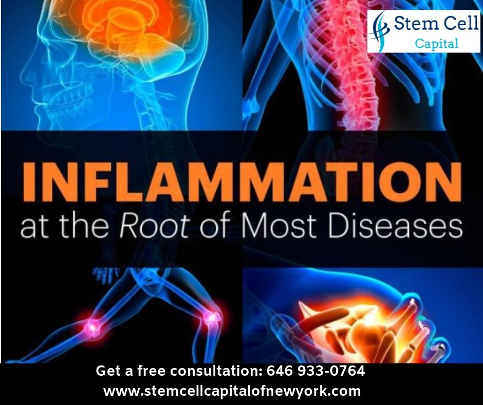 Ashleylrd's tweet photo. #Inflammation is part of the body's immune response to an injury, irritation or surgery.
Get More Details: https://t.co/iAHsEwq4Vi

#Immunity #Injury #Pain #Swelling #dearInstagram #StemCells #NewYorkCity #HospitalsInNYC #ChryslerBuilding #Midtown #Newjersey #Kingston https://t.co/pD55lteFW6