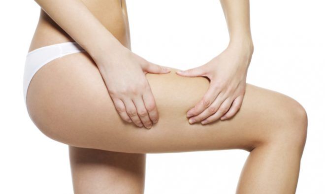 TrattaCellulite's tweet photo. Le ultime novità per combattere la #cellulite: la #liposuzione #medica con il #plasmalipo e la #dieta #chetogenica 
https://t.co/vDftLWxpH3 https://t.co/JH2gsChaD5