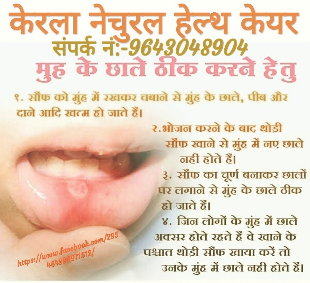 KeralaaC's tweet photo. Kerala Natural Health care
Mouth ulcers
#mouth #Mouthulcers #mouths
#like4follow #likeforlikes #like4likes #likeforfollow #healthtips #life #healthylifestyle #helthyfood #health https://t.co/9bRLOnHzhN