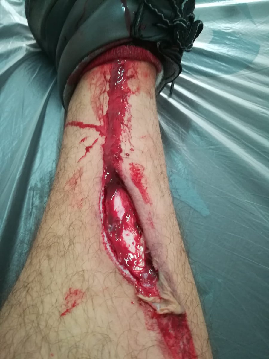 Maatii85's tweet photo. RT o te queda la gamba como mí viejo https://t.co/QIu0kQZNaA