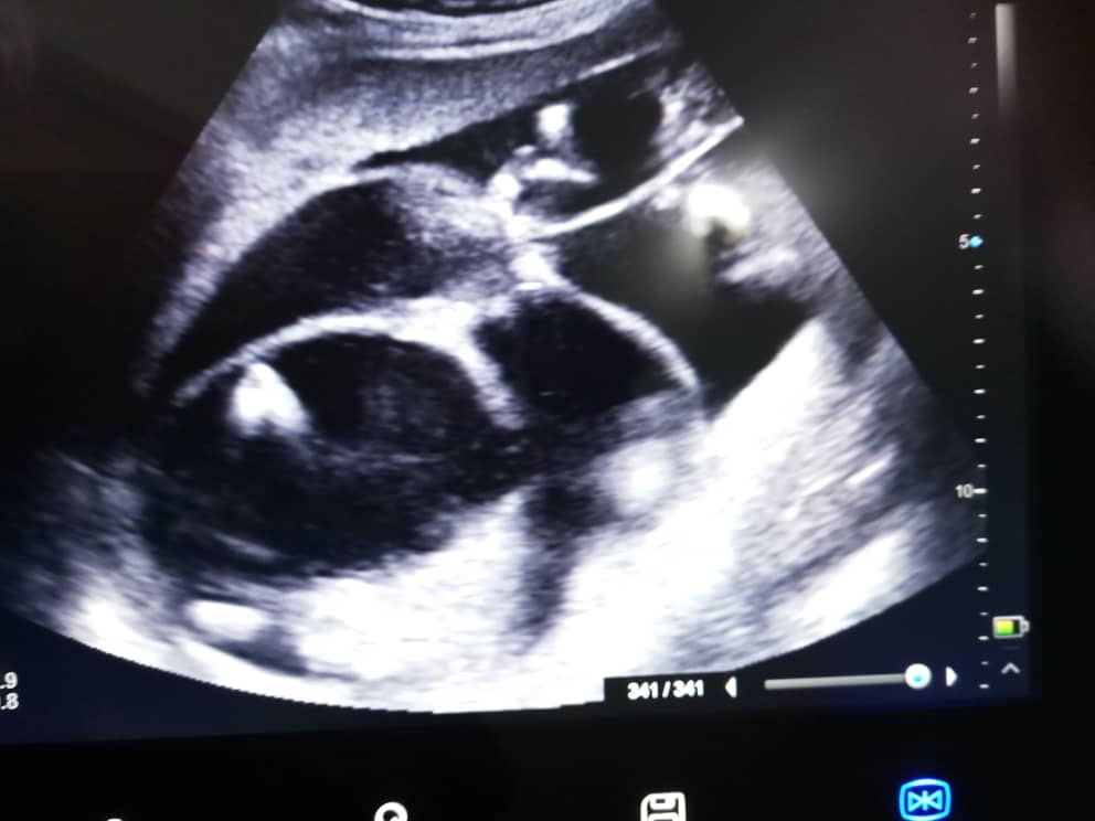 meetsurrogates's tweet photo. Our best scan for 2018 https://t.co/KUYKZALw4H