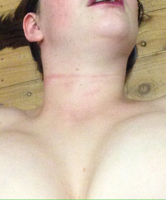 I am LOVING my new collar but it's more like a choker. Look at those marks left after wearing it for<a href="/tag/aesthetics"class="tags"><span>#aesthetics</span></a><a href="/tag/choker"class="tags"><span>#choker</span></a><a href="/tag/collargirl"class="tags"><span>#collargirl</span></a>