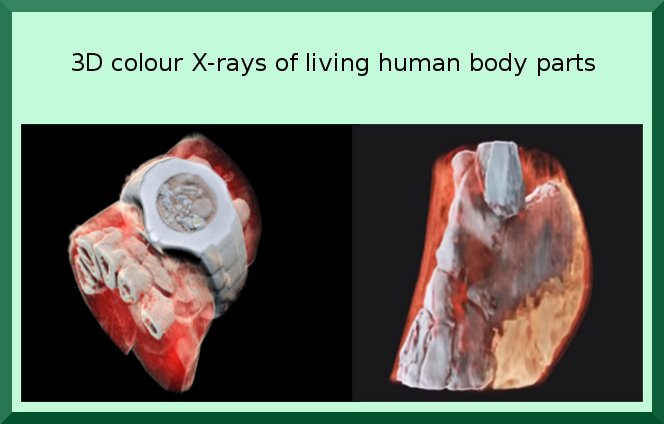 TamilTechNews's tweet photo. First 3D colour X-ray of a Human using CERN technology https://t.co/NYfDy0WavT https://t.co/TYltjMivaS #3dXray #Medical #Health #Technology