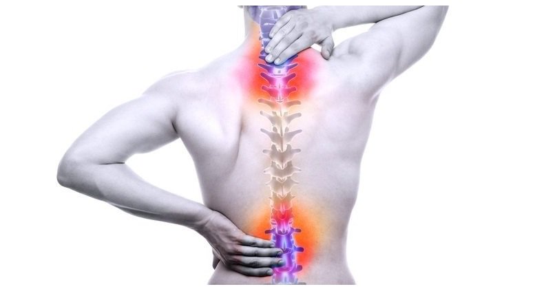 ergocontrol's tweet photo. El dolor de espalda y el rendimiento humano en la #Ergonomía https://t.co/4Zb3AbMT74 https://t.co/5bwqvUK8Mc