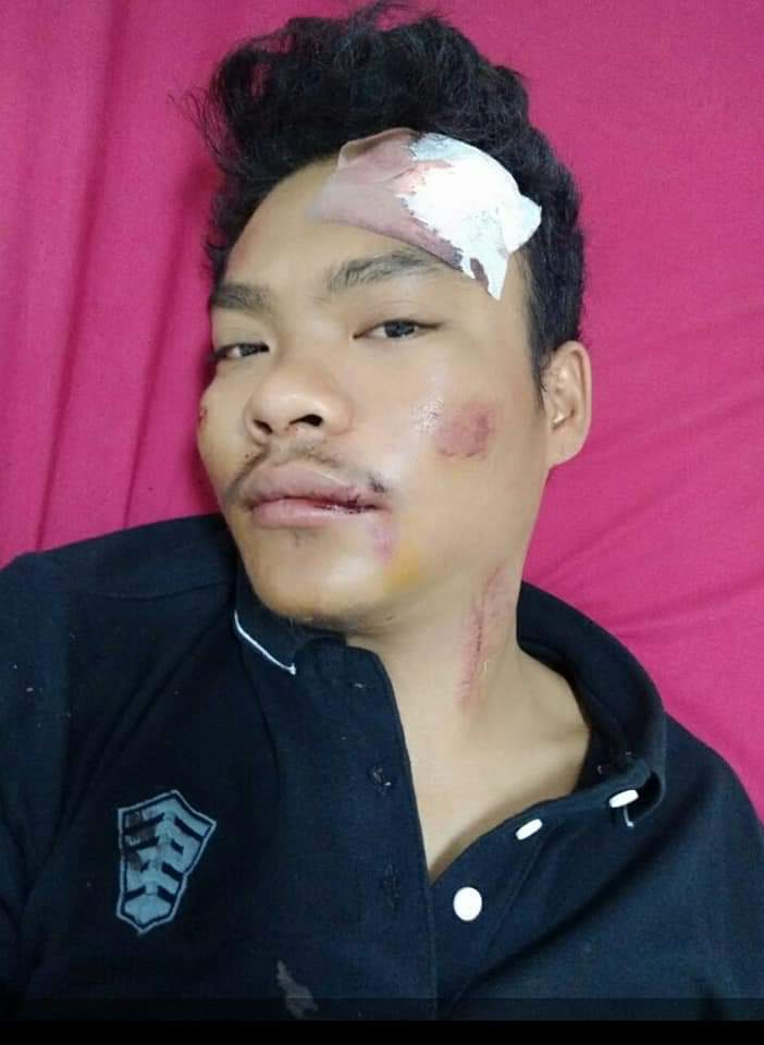 Kecelakaan Ketika bertugas..
Moga cepat sembuh Sahabat Agung Nur Banser Kab Bulukumba Sulsel
@mamans7880
@iskandar_moh
@TotokPurwanto19
@GPAnsor_Satu
@PW_AnsorSulsel.@AfifFuadS @amrudinnejad_