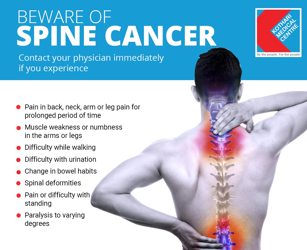 KOTHARI MEDICAL CENTRE on Twitter "Spine Cancer occurs with abnormal