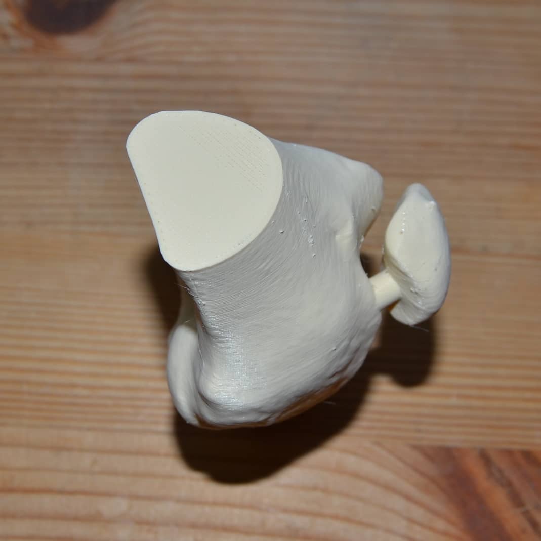 de3dprintman's tweet photo. This Knee from CT scan (@thingiverse thing:2303598) is printed on the #YAN3Dprinter by @FurlingTech in 0,1 mm layers and 20% infill in OSSO #Healthfil PLA by @tr333d filaments. Sliced in #Slic3r with my profile for YAN and it came out real good. #3DPrinting https://t.co/P4r6QaUqWd