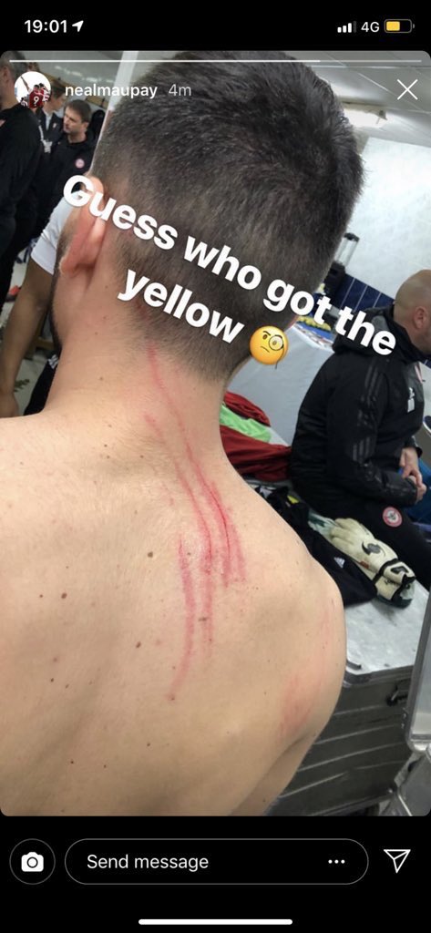 Beesotted's tweet photo. Neal Maupay making his point

#bcfc fans thought the ref was shit when he booked five of ours &amp; none of theirs 🤔 https://t.co/QuBZqUeFIA