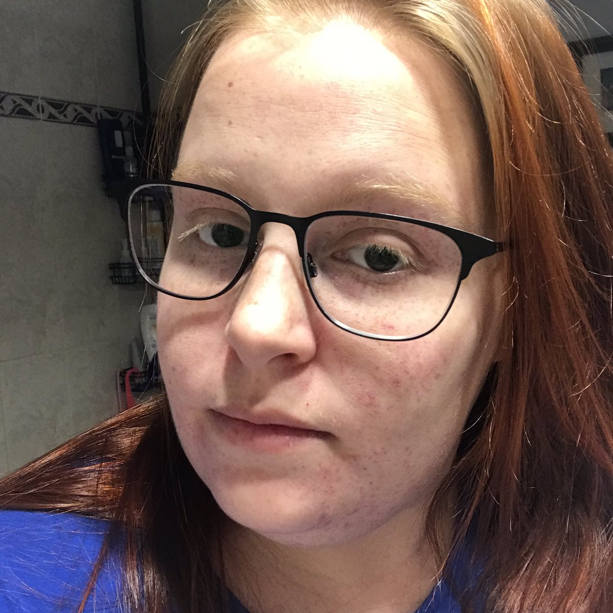 Get H Petechiae Etiketa Sto Twitter Free Wallpaper H Petechiae Etiketa Sto Twitter For Android Free