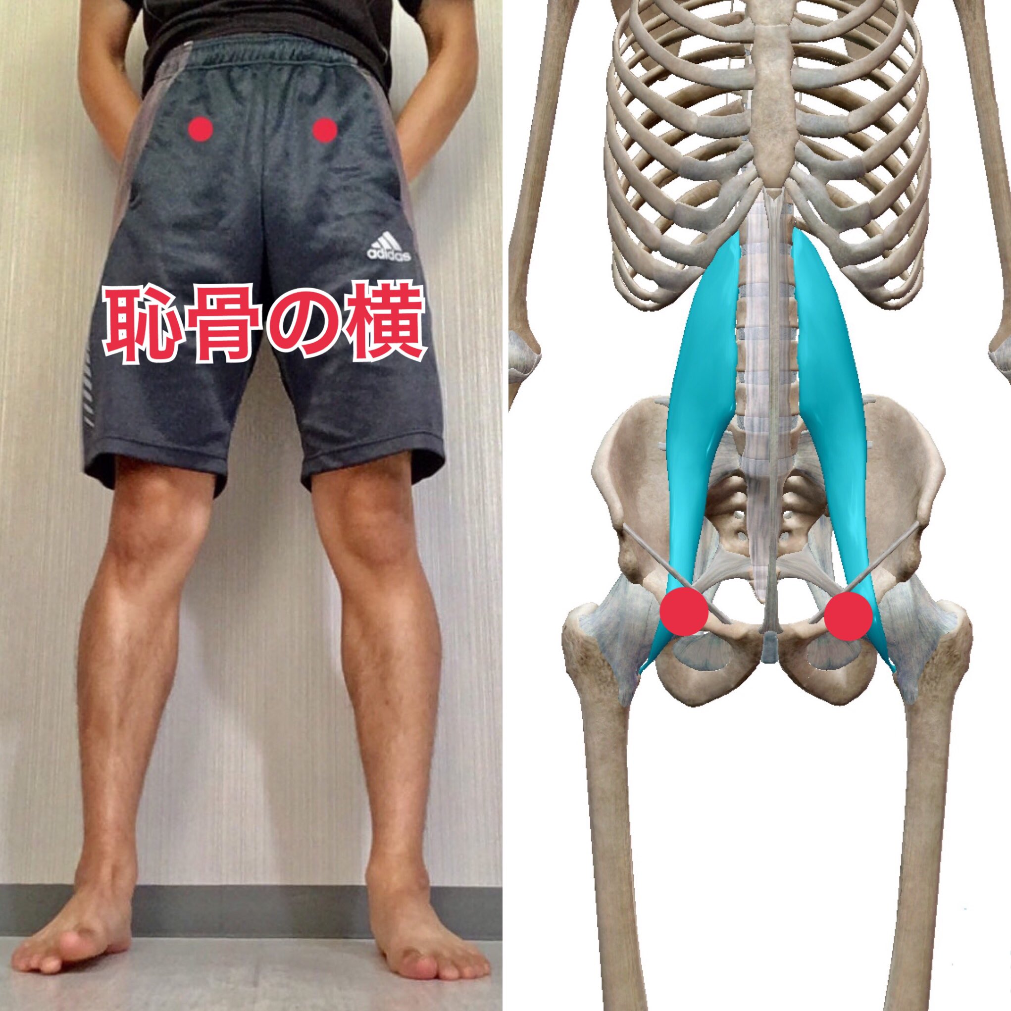 柴 雅仁 治療家 パーソナルトレーナー Auf Twitter 足首が固い しゃがめない という方は その原因が股関節にあったりする それは 股関節と足首の動きを悪くする筋肉が繋がっているから この筋肉を使わないようにするには 股関節のインナーマッスルがある部分に