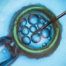 PalmBeachCMA's tweet photo. The majority of U.S. #AssistedReproductionTechnology clinics offer non-medical #sexselection, a percentage that has increased substantially since last reported in 2006
@NCBCenter @catholicmed @usccbprolife @Bioethicsnews 
https://t.co/nfgf7QCHOY https://t.co/xsgHMWoDjt
