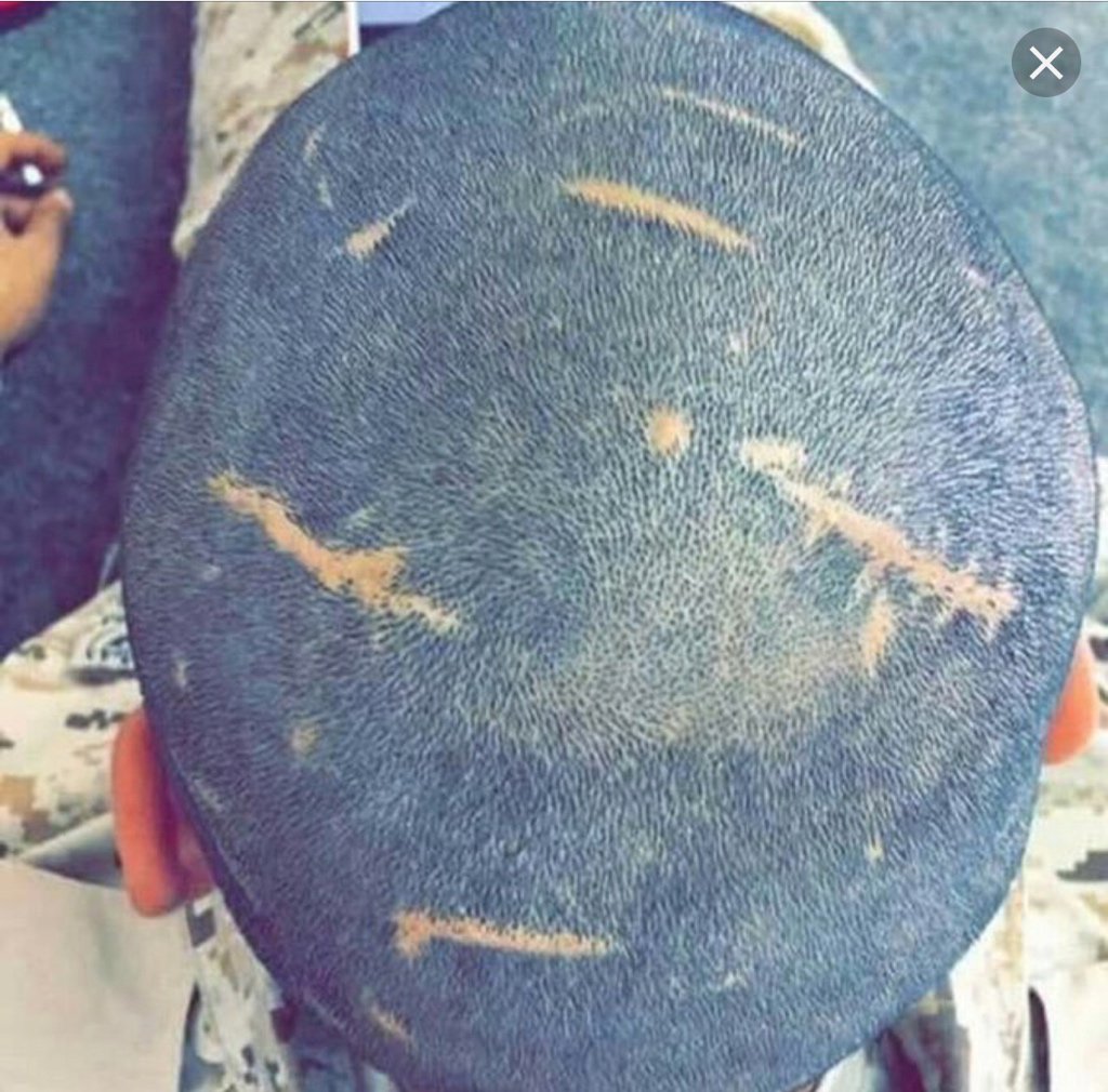 alajmi12345's tweet image. راس سنه ٢٠١٨

#سنه_2018_بكلمتين