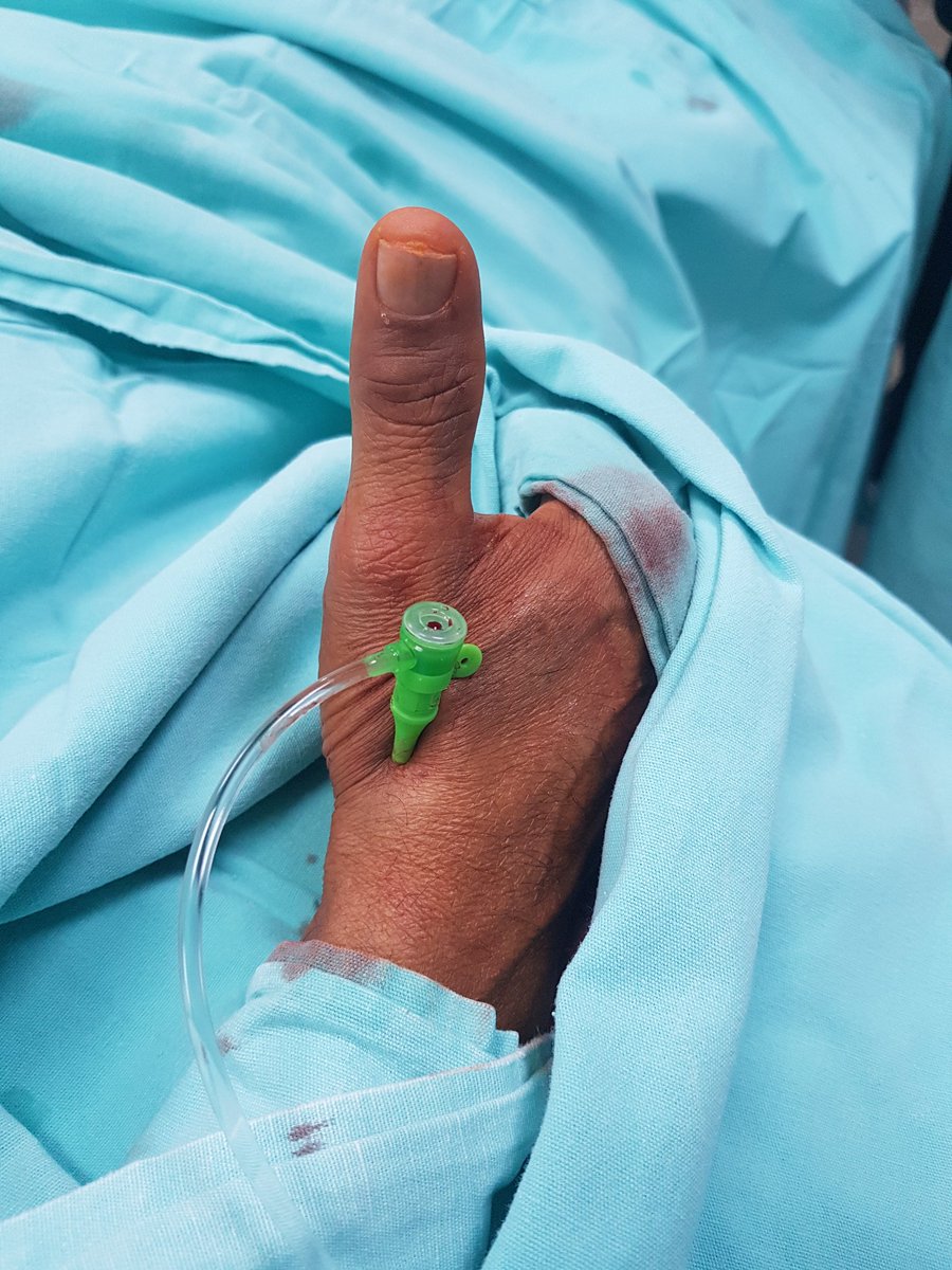 drgianma's tweet photo. 2018, a very good year to start with #ldTRA and to continue with #RadialFirst in #INCCathlab https://t.co/gpNKCCa23c