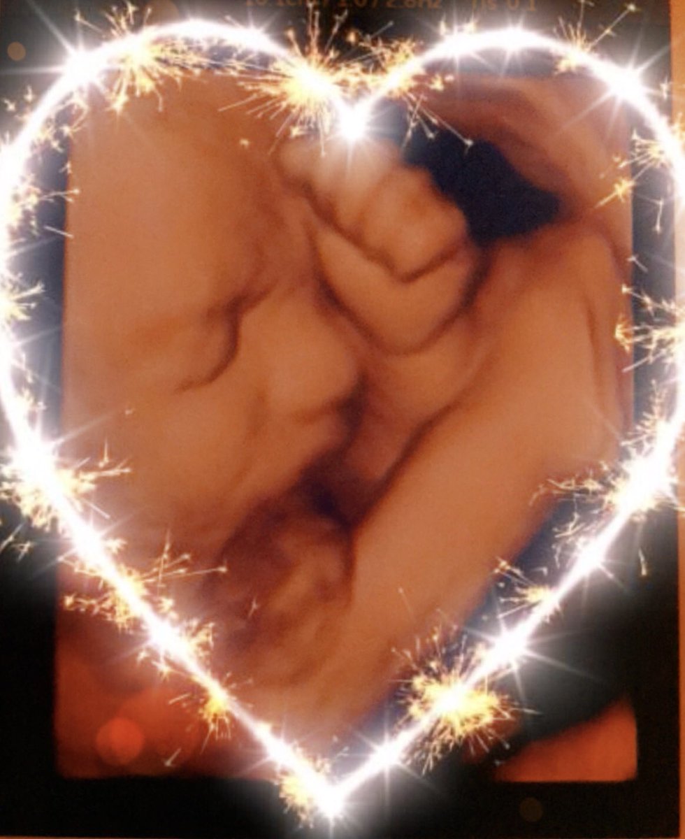 Echotoon's tweet photo. Lieve moeders, vaders, ouders (to be). Dank voor alle bijzondere momenten dat wij met jullie in 2018 mochten beleven, velen heel mooi en waardevol, sommige helaas ook verdrietig. Voor 2019 veel mooie liefdevolle momenten! We wensen jullie alle geluk! 🖤
Lysanne Maaike Patricia https://t.co/vsFEatJmgt