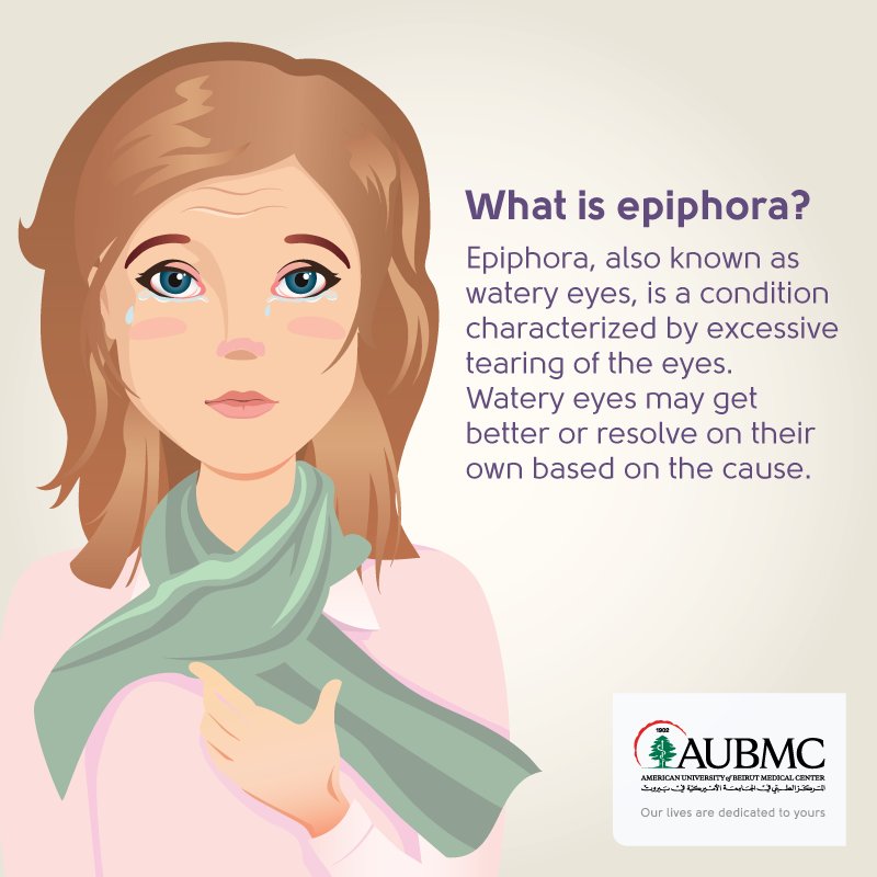 AUBMC_Official's tweet image. #DidYouKnow #Epiphora