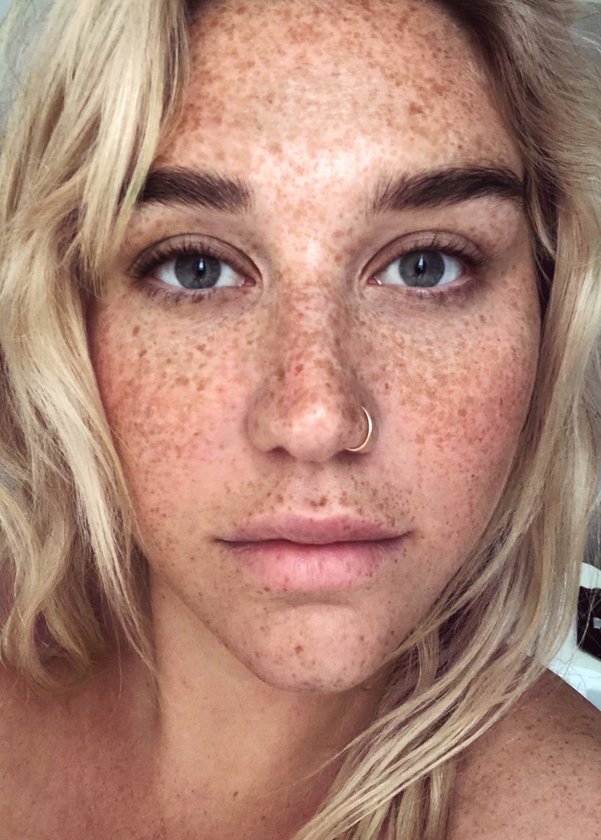 Singer Kesha Posted Pic Without Makeup And Freckles Are Beautiful