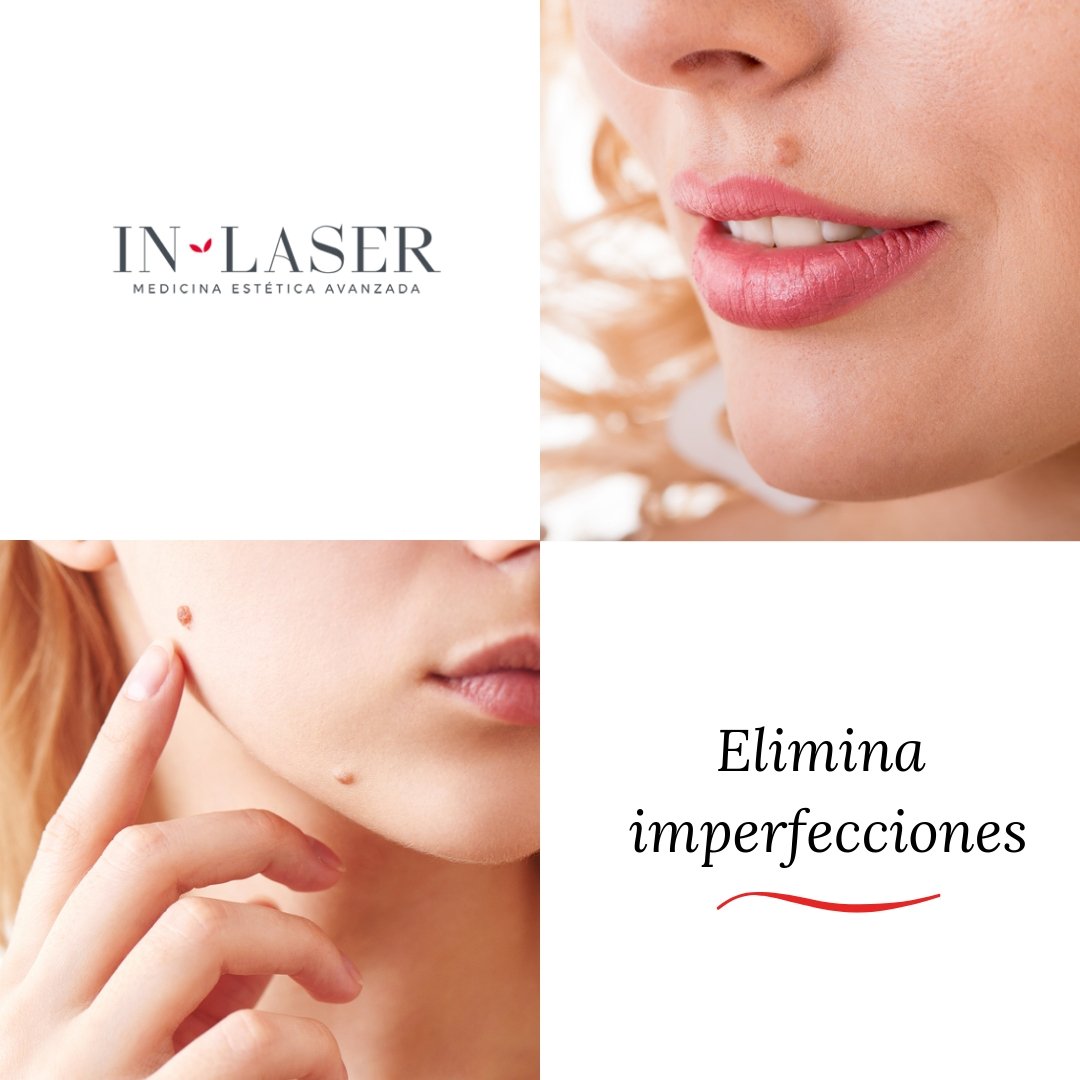 Inlaser_Oficial's tweet photo. Gracias cuestiones genéticas, pueden aparecen en nuestra piel imperfecciones que pueden llegar a incomodarnos.

Descubre los servicios que tenemos para eliminar las imperfecciones de tu rostro en el siguiente link: https://t.co/5PqXcZONek

#SaludYBelleza #CuidadoFacial https://t.co/zb9HwUnnWR