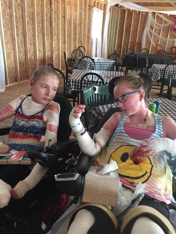 hblake_18's tweet photo. would give anything to have my bff back who had the same skin condition as me 💔🦋 #FuckEB #ButterflyChildren #EpidermolysisBullosa #EpidermolysisBullosaAwareness https://t.co/6w9QW5pCJL