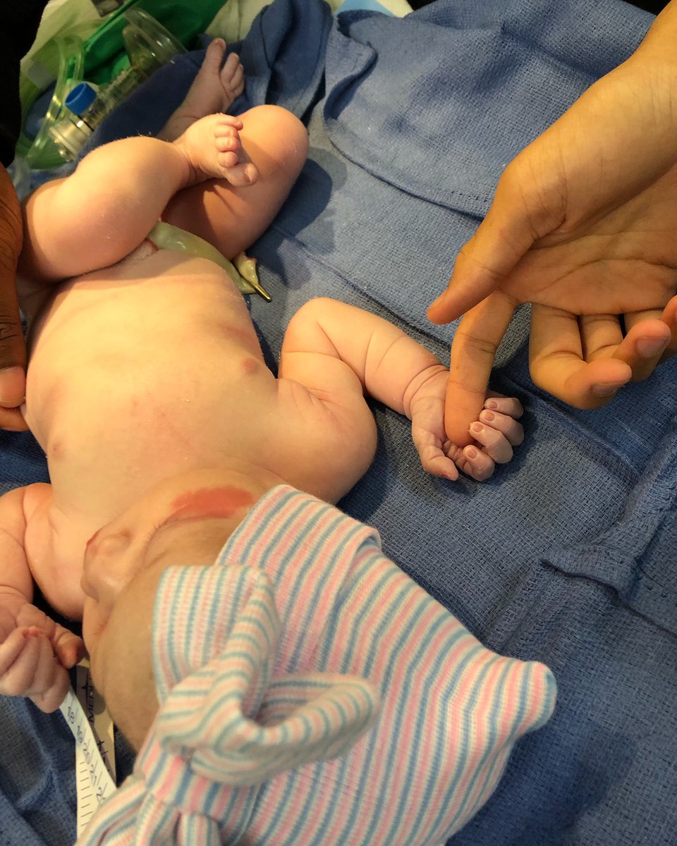 MorganHardman's tweet photo. God is so good. We are beyond blessed to welcome our baby girl into the world 
Ariah Ellice Nickson 
6lbs 14oz 20 1/2 in 
Sunday January 13, 2019 at 3:45am God Sent us another Angel https://t.co/ghq39WdyRX