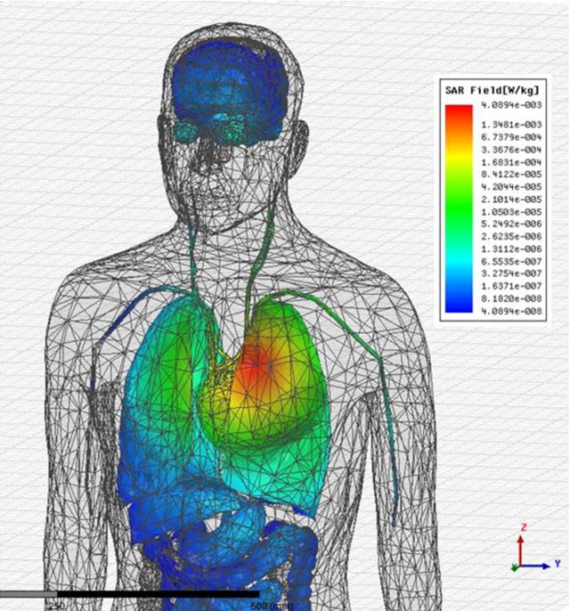 Human Body Model ANSYS App: bit.ly/2sp6U6r
Addressing complexity of experiments (in vitro) and reduce time and cost of clinical trials (in vivo), regulatory authorities encourage Virtual Patients (in silico) to complement traditional approaches.
#ANSYS #insilico