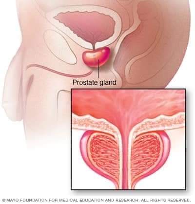 virginwindy's tweet photo. What you should know about PROSTATE CANCER
https://t.co/PksPecRfTh https://t.co/GNh67mZc5Q