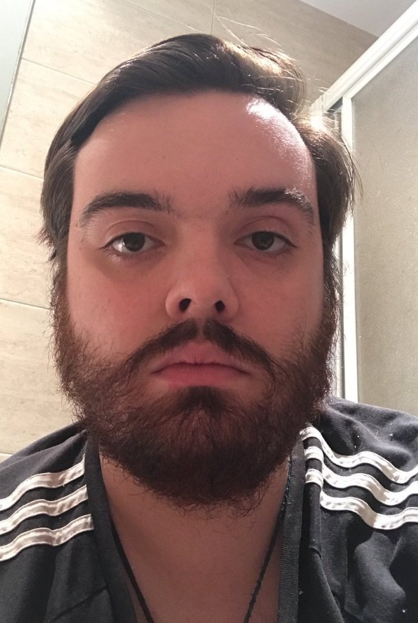 chunonegro's tweet image. #PubertyChallenge