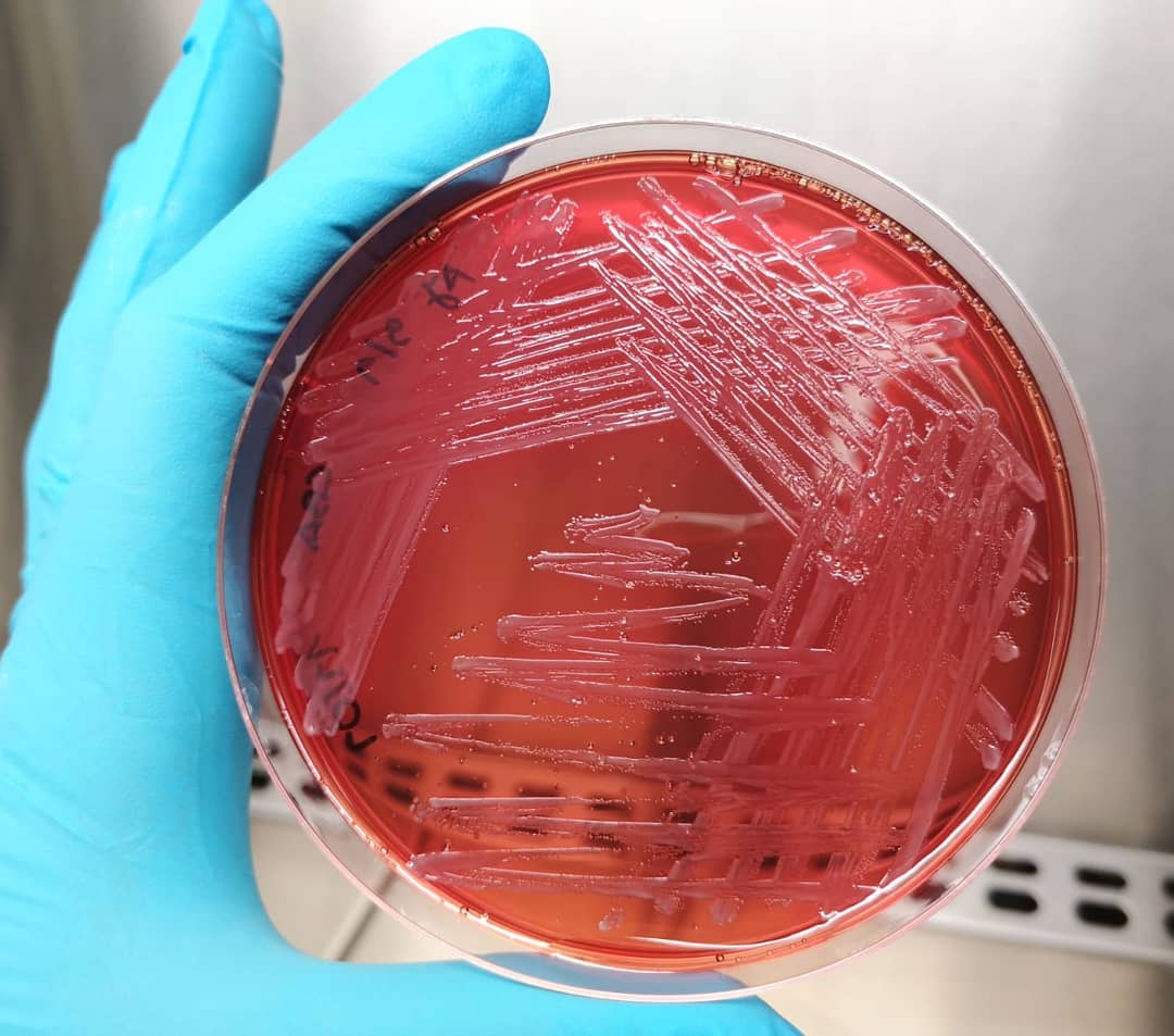 #cutibacteriumacnes is a major colonizer of the human skin causing the  chronic skin disease #acne.
<a href="/projectAMALIA/">AMALIA project</a>  is finding in #seaweeds the potential to tackle this problem!

<a href="/Lemos_lab/">Lemos Lab</a> #COSMETICS #IPLeiria #microbiology