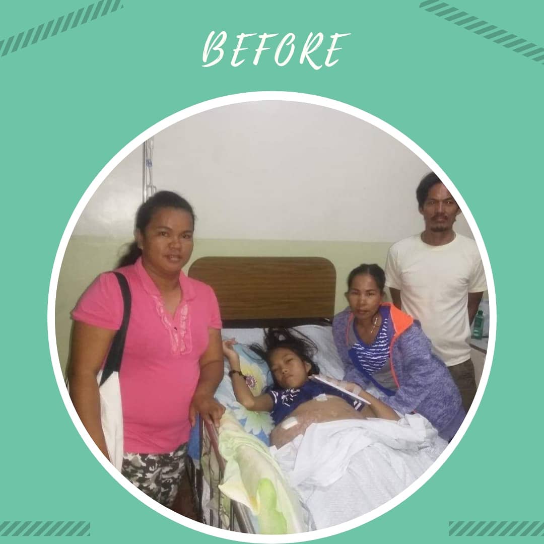 helpkidsinPH's tweet image. Rona got her XMas miracle 😍 Thanks to Future Electronics &amp;amp; another donor who wants to remain anonymous, we can help not only Rona, but also d other kids in d next 2 months, as we received a considerable amount of over 5000 Euro last month. 😍 ++

#helpforkids #donation #charity