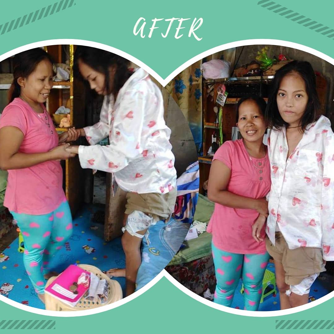 helpkidsinPH's tweet image. Rona got her XMas miracle 😍 Thanks to Future Electronics &amp;amp; another donor who wants to remain anonymous, we can help not only Rona, but also d other kids in d next 2 months, as we received a considerable amount of over 5000 Euro last month. 😍 ++

#helpforkids #donation #charity